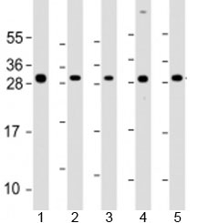 Western blot testing of human 1) SK-BR-3, 2) HeLa, 3) HCT116, 4) MCF-7 and 5) HL-60 cell lysate with NAA10 antibody at 1:2000. Predicted molecular weight: 26 kDa.