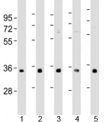 Western blot testing of human 1) A431, 2) HeLa, 3) HepG2, 4) Jurkat and 5) U-2OS cell lysate with RNPS1 antibody at 1:1000. Predicted molecular weight: 34 kDa.