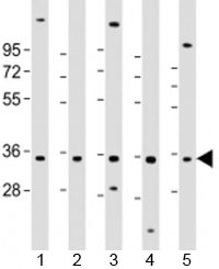 Western blot testing of human 1) HL-60, 2) K562, 3) MCF-7, 4) MOLT-4 and 5) SH-SY5Y cell lysate with PIGC antibody at 1:2000. Predicted molecular weight: 34 kDa.