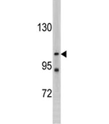 Western blot testing of LLGL2 antibody and K562 cell lysate. Predicted molecular weight ~113 kDa.