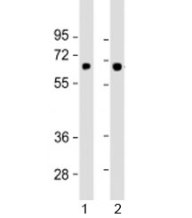 Western blot testing of human 1) SK-BR-3 and 2) TT cell lysate with SLC5A8 antibody at 1:1000. Predicted molecular weight: 67 kDa.