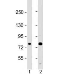 Western blot testing of human 1) A431 and 2) U-2OS cell lysate with MAN1A2 antibody at 1:2000. Predicted molecular weight: 73 kDa.