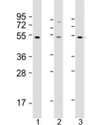 Western blot testing of human 1) HT-1080, 2) SH-SY5Y and 3) Y79 cell lysate with ZNF513 antibody at 1:2000. Predicted molecular weight: 58 kDa.