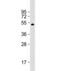 Western blot testing of recombinant protein with AKAP13 antibody at 1:8000.