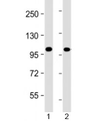 Western blot testing of human 1) Jurkat and 2) K562 cell lysate with PRDM16 antibody at 1:4000. Predicted molecular weight: 140 kDa.