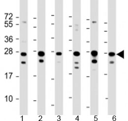 Western blot testing of human 1) HeLa, 2) HepG2, 3) Jurkat, 4) Raji, 5) 293 and 6) 293T/17 cell lysate with PCMT1 antibody at 1:2000. Predicted molecular weight: 25 kDa.