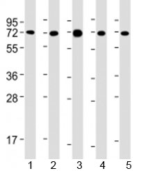 Western blot testing of human 1) MCF-7, 2) PC-3, 3) COS-7, 4) DU-145 and 5) SK-BR-3 cell lysate with USP2 antibody at 1:2000. Predicted molecular weight: 68 kDa. Isoforms at ~41 and ~45 kDa may also be observed.