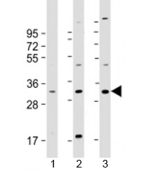 Western blot testing of human 1) U-2OS, 2) U-251 MG and 3) A431 cell lysate with FAM125A antibody at 1:2000. Predicted molecular weight: 29 kDa.