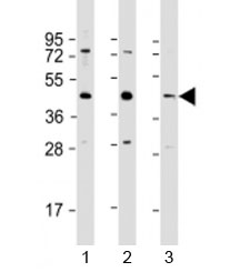 Western blot testing of 1) human HeLa, 2) human A549 and 3) mouse brain lysate with G6PC3 antibody at 1:1000. Predicted molecular weight: 39 kDa.