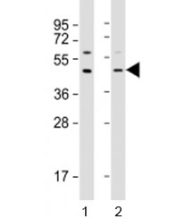 Western blot testing of human 1) A549 and 2) HepG2 cell lysate with APOL3 antibody at 1:2000. Predicted molecular weight: 44 kDa.