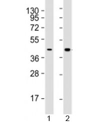 Western blot testing of human 1) HepG2 (liver carcinoma line) and 2) liver lysate with AGXT antibody at 1:2000. Predicted molecular weight: 43 kDa.