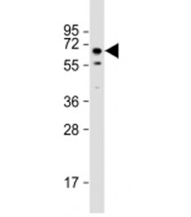 Western blot testing of mouse testis lysate with TOR1AIP1 antibody at 1:2000. Predicted molecular weight: 66 kDa.