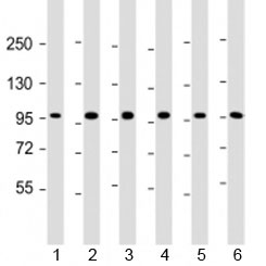 Western blot testing of human 1) HepG2, 2) U-251 MG, 3) A431, 4) HeLa, 5) CCRF-CEM and 6) HL-60 cell lysate with TAF4 antibody at 1:2000. Predicted molecular weight: 110-135 kDa.