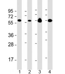 Western blot testing of 1) Daudi, 2) HL-60 cell lysate, 3) human brain and 4) mouse brain lysate with PACSIN2 antibody at 1:2000. Predicted molecular weight: 56 kDa.