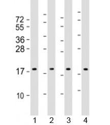 Western blot testing of human 1) HepG2, 2) HeLa, 3) Caki-1 and 4) HT-29 cell lysate with ARF4 antibody at 1:2000. Predicted molecular weight: 21 kDa.