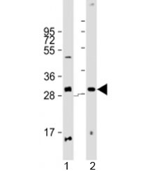 Western blot testing of human 1) pancreas and 2) placenta lysate with PPP1R3E antibody at 1:2000. Predicted molecular weight: 31 kDa.