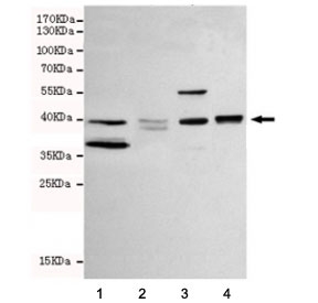 Western blot testing of human 1) MCF-7, 2) ZR75-1, 3) MDA-MB-468 and 4) T47D cell lysate with WNT3A antibody at 1:1000. Predicted molecular weight: 35-44 kDa depending on glycosylation level.