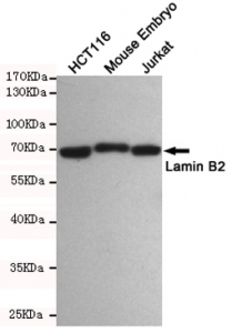 Western blot testing of 1) human HCT116, 2) mouse embryo and 3) human Jurkat cell lysates using Lamin B2 antibody at 1:500. Predicted molecular weight ~70 kDa.