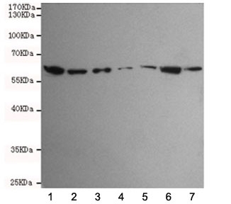 Western blot testing of human 1) HCT116, 2) SW480, 3) HepG2, 4) A549, 5) Jurkat, 6) K562 and 7) HeLa cell lysates using TAB1 antibody at 1:1000. Predicted molecular weight ~55 kDa.