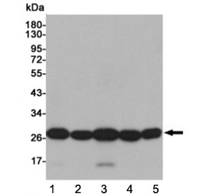 Western blot testing of human 1) HeLa, 2) THP-1, 3) A549, 4) Ramos and 5) K562 cell lysates using SOD2 antibody at 1:1000. Predicted molecular weight ~25 kDa.