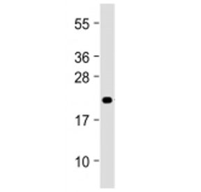 Western blot testing of MIF4GD antibody at 1:2000 + mouse liver lysate. Predicted molecular weight ~25 kDa.