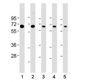 Western blot testing of PSMD3 antibody at 1:2000: Lane 1) human Jurkat, 2) (h) HeLa, 3) (h) HepG2, 4) (h) MCF-7 and 5) mouse NIH3T3 cell lysate. Predicted molecular weight ~61 kDa.