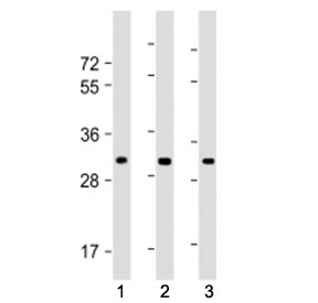Western blot testing of CH25H antibody at 1:1000: Lane 1) human brain lysate, 2) mouse heart lysate and 3) mouse lung lysate. Predicted molecular weight ~32 kDa.