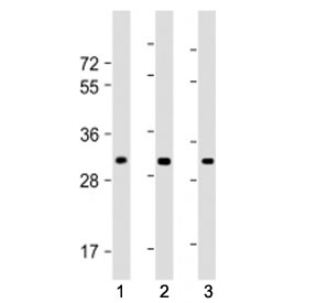Western blot testing of CH25H antibody at 1:1000: Lane 1) human brain lysate, 2) mouse heart lysate and 3) mouse lung lysate. Predicted molecular weight ~32 kDa.