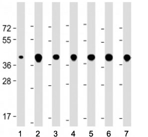 Western blot testing of TOMM40 antibody at 1:2000: Lane 1) human brain, 2) HEK293, 3) U-87 MG, 4) Hut78, 5) HeLa, 6) A431 and 7) HepG2 cell lysate. Predicted molecular weight ~37 kDa.