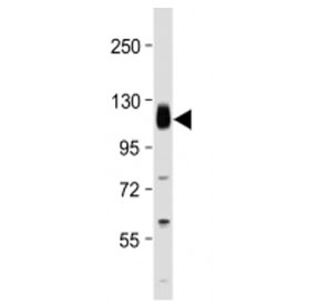 Western blot testing of Thrombomodulin antibody at 1:2000 + human THP1 cell lysate. Expected molecular weight ~60/100 kDa (unmodified/glycosylated).