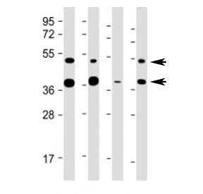 Western blot testing of FDPS antibody at 1:2000: Lane 1) human HeLa, 2) (h) HepG2, 3) (h) U-251 MG and 4) mouse liver lysate. Predicted molecular weight ~48 kDa (isoform 1) and ~40 kDa (isoform 2).