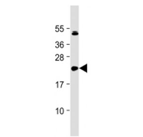 Western blot testing of IL-11 antibody at 1:2000 + human DU145 cell lysate. Predicted molecular weight: 19-23 kDa.