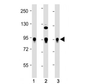 Western blot testing of Wee1 antibody at 1:2000: Lane 1) human HeLa, 2) Jurkat and 3) K562 cell lysate. Predicted molecular weight ~72 kDa.