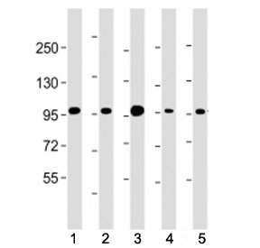 Western blot testing of Beta Catenin antibody at 1:4000: Lane 1) human HEK293, 2) (h) HeLa, 3) monkey COS-7, 4) rat C6 and 5) mouse NIH3T3 cell lysate. Predicted molecular weight ~85 kDa, but routinely observed at 90-95 kDa.