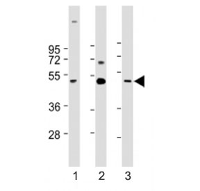 Western blot testing of CX3CL1 antibody at 1:1000: Lane 1) human brain, 2) heart and 3) lung lysate. Predicted molecular weight ~42 kDa.