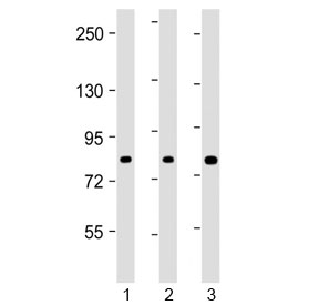 Western blot testing of human 1) HEK293, 2) HT-29 and 3) U-2 OS cell lysate with ADD1 antibody at 1:2000. Predicted molecular weight ~81 kDa.