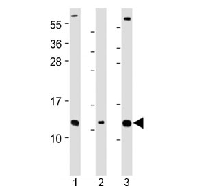 Western blot testing of human 1) Caco-2, 2) RMPI-8226 and 3) SH-SY5Y cell lysate with CKS2 antibody at 1:2000. Predicted molecular weight ~10 kDa.