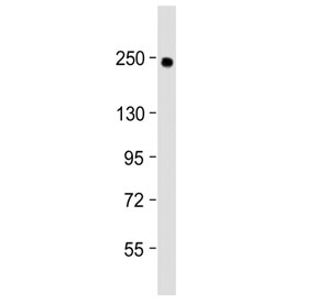 Western blot testing of human lung lysate with COL14A1 antibody at 1:2000. Predicted molecular weight ~194 kDa.