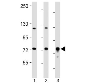 Western blot testing of 1) mouse kidney, 2) mouse lung and 3) rat lung tissue lysate with DLL4 antibody at 1:2000. Predicted molecular weight: 75-85 kDa.