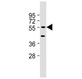 Western blot testing of mouse NIH3T3 cell lysate with DNAJC3 antibody at 1:2000. Predicted molecular weight ~58 kDa.