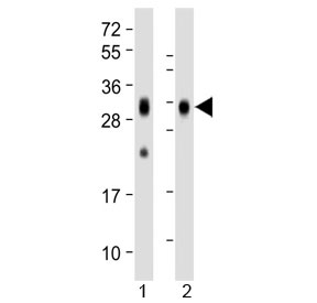 Western blot testing of human 1) spleen and 2) placenta lysate with Folate Receptor beta antibody at 1:1000. Predicted molecular weight ~29 kDa.