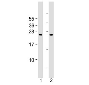 Western blot testing of human 1) cerebellum and 2) spleen tissue lysate with Grancalcin antibody at 1:2000. Predicted molecular weight ~24 kDa.