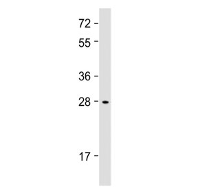 Western blot testing of human Li-7 cell lysate with IGFBP1 antibody at 1:2000. Expected molecular weight: 28-35 kDa.