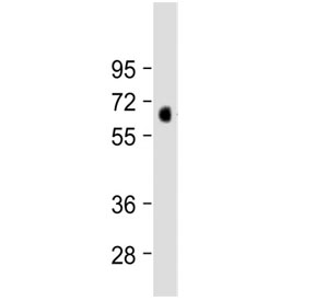 Western blot testing of human lung tissue lysate with MKS1 antibody at 1:2000. Predicted molecular weight ~65 kDa.