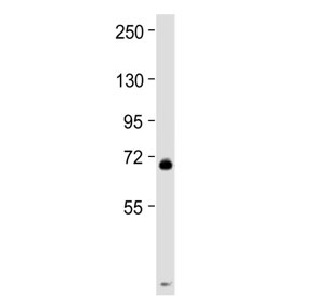 Western blot testing of mouse spleen tissue lysate with MPL antibody at 1:2000. Predicted molecular weight ~71 kDa.