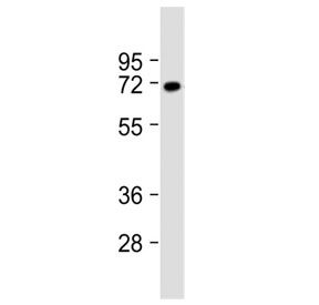 Western blot testing of rat brain lysate with VGLUT2 antibody at 1:2000. Predicted molecular weight ~64 kDa.
