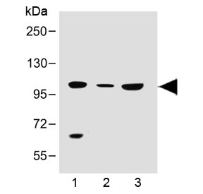 Western blot testing of human 1) 293T/17, 2) brain and 3) K562 lysate with SLC14A2 antibody at 1:500. Predicted molecular weight ~101 kDa.