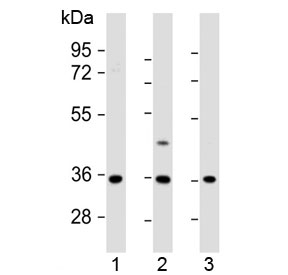 Western blot testing of human 1) U-87 MG, 2) U-2 OS and 3) MDA-MB-231 cell lysate with OR2AE1 antibody at 1:1000. Predicted molecular weight ~37 kDa.