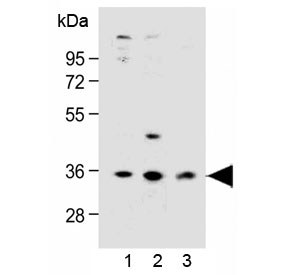 Western blot testing of human 1) LNCaP, 2) PC-3 and 3) HEK293 cell lysate with OR6C3 antibody at 1:1000 dilution. Predicted molecular weight ~35 kDa.