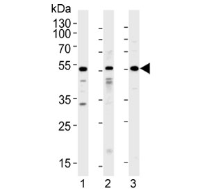 Western blot testing of 1) human A549, 2) human HepG2 and 3) rat testis lysate with ALK2 antibody at 1:1000. Predicted molecular weight ~57 kDa.